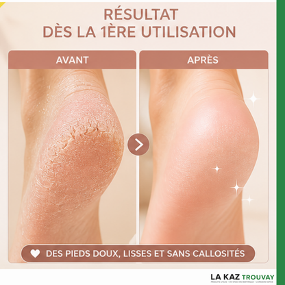 NEWS 2026 : Ponceuse Pied + Main Portable Pro™ – Pieds Doux & Lisses Dès La 1ère Utilisation